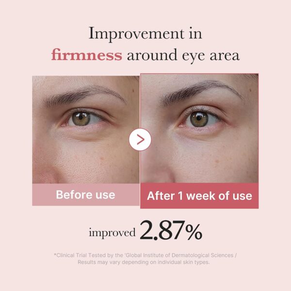 medicube Eye Serum with Salmon DNA PDRN & Pink Peptides | 99% Purity Retinol for Fine Lines | PDRN & Niacinamide for Uneven Skin Tone | Korean Skincare, 1.01 fl.oz
