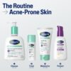 71cxuHR5jL._SL1500_.jpg Cetaphil Gentle Clear Pore Clearing Acne Cleanser, Foaming Gel Cleanser for Sensitive, Acne-Prone Skin, 8 Fl Oz Pump Bottle, 2% Salicylic Acid, Gently Exfoliates, Dermatologist Recommended Brand