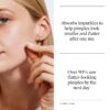 Neutrogena Stubborn Acne Patches, Hydrocolloid Absorbs Impurities Ultra-Thin Pimple Patches Work Overnight, 24 ct