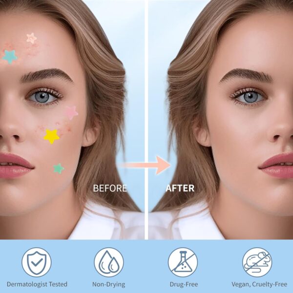 71nr1eWRtxL._SL1500_.jpg QUSTERE Pimple Patches for Face, Hydrocolloid Acne Patches, Cute Star Zit Covers, Colorful Spot Stickers with Tea Tree, Salicylic Acid & Cica Oil| 3 Sizes (10mm, 12mm & 14mm) |200 Count