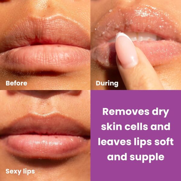 816vZm9R0dL._SL1500_.jpg Dermasuri - Lip Exfoliator Scrub & Moisturizer - Sugar Scrubs, Overnight Hydration & Softening - Brighten & Soften Dark Lips For Men & Women -Soothing Dryness -Coconut Passion Fruit Flavor - 20g/0.7oz