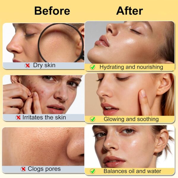 DOYEEWO Skin Care Set,6Pcs Women Teen Glass Skincare w/Korean Rice Extract,Hydrate Glow Repair Anti-Aging Facial Routine Kit Self Care Gifts for Women Mom Wife Teenage Girl Valentines Christmas Gifts