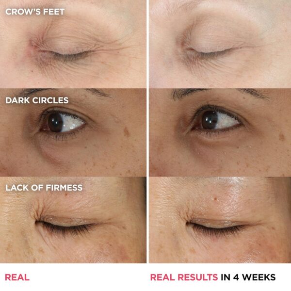 81WqpPL6vhL._SL1500_.jpg IT Cosmetics Confidence in an Eye Cream - Anti Aging Peptides Moisturizer, Dark Circles & Wrinkles, Lightweight 48H Hydration, 2% Super Peptide Concentrate, Smooth & Brighten Undereye, All Skin Types