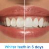 81emI-ZJh0L._AC_SL1500_.jpg Crest 3D White Advanced, Teeth Whitening Toothpaste for Adults, 3.7 oz, 4 Pack, Cavity Protection Fluoride Toothpaste, Strengthens Enamel, Travel Size Toiletries