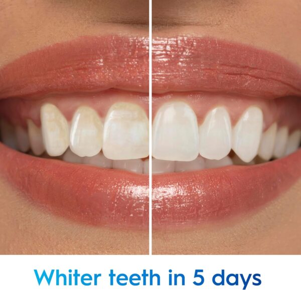 81emI-ZJh0L._AC_SL1500_.jpg Crest 3D White Advanced, Teeth Whitening Toothpaste for Adults, 3.7 oz, 4 Pack, Cavity Protection Fluoride Toothpaste, Strengthens Enamel, Travel Size Toiletries