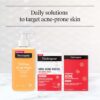 Neutrogena Stubborn Acne Patches, Hydrocolloid Absorbs Impurities Ultra-Thin Pimple Patches Work Overnight, 24 ct