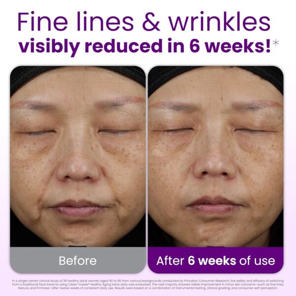 91J1lODLgUL._SL1500_.jpg Reduces Fine Lines and Wrinkles in 6 weeks or Less, CLEAN SKIN CLUB Healthy Aging Clean Towels® XL, Disposable Face Towels, XL - 1 Pack (50 count)