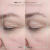 91kqTjXNTnL._SL1500_.jpg BIOEFFECT EGF Eye Serum with De-Puffer Rollerball | Age-Defying Under Eye Treatment with Epidermal Growth Factor for Fine Lines, Wrinkles, Puffiness & Sagging 6 mL / 0.20 oz