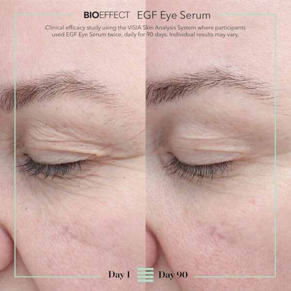 91kqTjXNTnL._SL1500_.jpg BIOEFFECT EGF Eye Serum with De-Puffer Rollerball | Age-Defying Under Eye Treatment with Epidermal Growth Factor for Fine Lines, Wrinkles, Puffiness & Sagging 6 mL / 0.20 oz